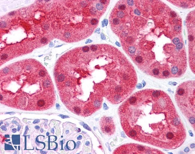 Anti-FAH antibody IHC of human kidney. Immunohistochemistry of formalin-fixed, paraffin-embedded tissue after heat-induced antigen retrieval. Antibody LS-B4589 concentration 5 ug/ml.