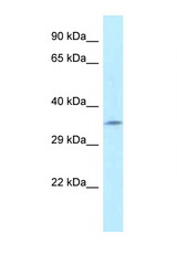 FAHD2A antibody LS-C145837 Western blot of Fetal Kidney lysate. Antibody concentration 1 ug/ml.