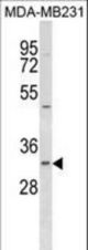FAHD2B Antibody western blot of MDA-MB231 cell line lysates (35 ug/lane). The FAHD2B Antibody detected the FAHD2B protein (arrow).