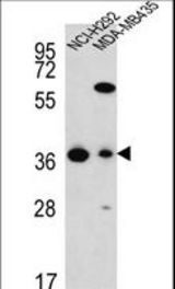 FAHD2A Antibody western blot of NCI-H292,MDA-MB435 cell line lysates (35 ug/lane). The FAHD2A antibody detected the FAHD2A protein (arrow).