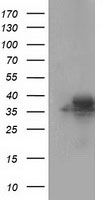 HEK293T cells were transfected with the pCMV6-ENTRY control (Left lane) or pCMV6-ENTRY FAHD2A (Right lane) cDNA for 48 hrs and lysed. Equivalent amounts of cell lysates (5 ug per lane) were separated by SDS-PAGE and immunoblotted with anti-FAHD2A.