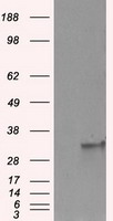 HEK293T cells were transfected with the pCMV6-ENTRY control (Left lane) or pCMV6-ENTRY FAHD2A (Right lane) cDNA for 48 hrs and lysed. Equivalent amounts of cell lysates (5 ug per lane) were separated by SDS-PAGE and immunoblotted with anti-FAHD2A.