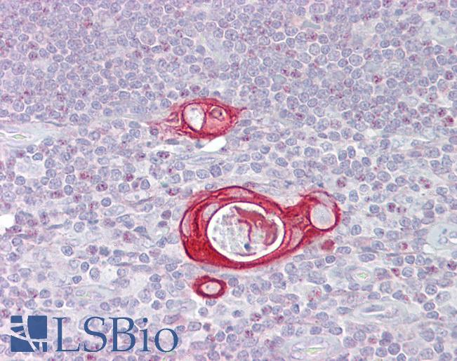 Anti-FAIM / FAIM1 antibody IHC of human thymus. Immunohistochemistry of formalin-fixed, paraffin-embedded tissue after heat-induced antigen retrieval. Antibody LS-B6913 concentration 5 ug/ml.