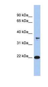 FAIM / FAIM1 antibody LS-B6913 Western blot of Jurkat lysate.