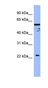FAIM / FAIM1 antibody LS-C107753 Western blot of OVCAR-3 cell lysate.