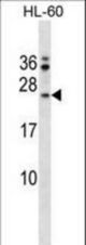 FAIM Antibody western blot of HL-60 cell line lysates (35 ug/lane). The FAIM antibody detected the FAIM protein (arrow).