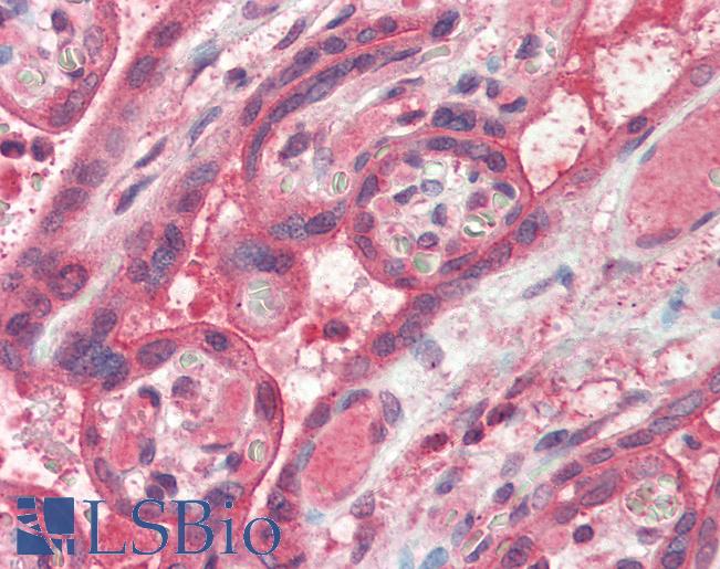 Anti-FAIM / FAIM1 antibody IHC of human placenta. Immunohistochemistry of formalin-fixed, paraffin-embedded tissue after heat-induced antigen retrieval. Antibody LS-B2452 concentration 5 ug/ml.