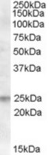 Antibody (0.5 ug/ml) staining of Human Lymph Node lysate (35 ug protein in RIPA buffer). Primary incubation was 1 hour. Detected by chemiluminescence.