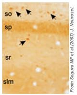 Distribution of FAIML-immunoreactive cells in the hippocampus of mice brain (3). Immunohistochemistry of P10 hippocampus sample. Sections of 100 uM were incubated overnight with the antibody. This primary antibody was visualized by sequential incubation with biotinylated secondary antibodies (1:200; Vector Laboratories, Burlingame, CA) and the streptavidine-peroxidase complex (1:400; Amersham Biosciences, Pittsburgh, PA). The peroxidase reaction was developed with diaminobenzidine and H2O2 . Some hippocampal interneurons scattered in all hippocampal layers show a strong immunostained signal (arrows). So, stratum oriens; sp, stratum pyramidale; sr, stratum radiatum; slm, stratum lacunosum-moleculare; sm, stratum moleculare.