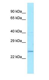 FAIM2 / LIFEGUARD antibody Western Blot of HepG2. Antibody dilution: 1 ug/ml.
