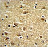 Formalin-fixed and paraffin-embedded human brain tissue reacted with PTK2 Antibody , which was peroxidase-conjugated to the secondary antibody, followed by DAB staining. This data demonstrates the use of this antibody for immunohistochemistry; clinical relevance has not been evaluated.