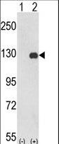 Western blot of PTK2 (arrow) using rabbit polyclonal PTK2 Antibody. 293 cell lysates (2 ug/lane) either nontransfected (Lane 1) or transiently transfected with the PTK2 gene (Lane 2).