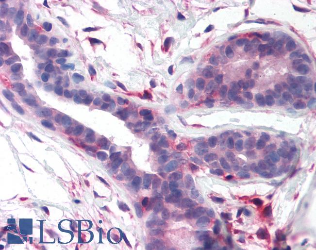 Anti-FAK antibody LS-A2957 IHC of human breast. Immunohistochemistry of formalin-fixed, paraffin-embedded tissue after heat-induced antigen retrieval.