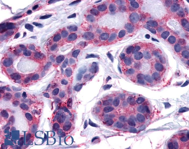Anti-FAK antibody LS-A2953 IHC of human lobular epithelium. Immunohistochemistry of formalin-fixed, paraffin-embedded tissue after heat-induced antigen retrieval.