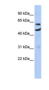 CNOT6 antibody LS-C101873 Western blot of Jurkat lysate.