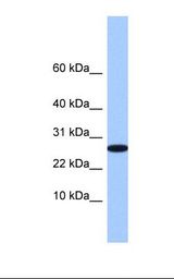 721_B cell lysate. Antibody concentration: 1.0 ug/ml. Gel concentration: 10-20%.