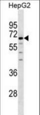 CNOT6 Antibody western blot of HepG2 cell line lysates (35 ug/lane). The CNOT6 antibody detected the CNOT6 protein (arrow).
