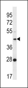 F105A Antibody western blot of K562 cell line lysates (35 ug/lane). The F105A antibody detected the F105A protein (arrow).