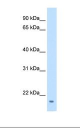 Transfected 293T cell lysate. Antibody concentration: 0.0625 ug/ml. Gel concentration: 15%.