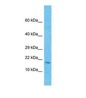 Western blot of Human large intestine Tumor. FAM107A antibody dilution 1.0 ug/ml.