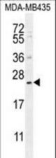 FAM109A Antibody western blot of MDA-MB435 cell line lysates (35 ug/lane). The FAM109A antibody detected the FAM109A protein (arrow).