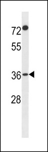 F110A Antibody western blot of A2058 cell line lysates (35 ug/lane). The F110A antibody detected the F110A protein (arrow).