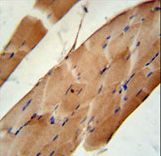 CNO6L Antibody immunohistochemistry of formalin-fixed and paraffin-embedded human skeletal muscle followed by peroxidase-conjugated secondary antibody and DAB staining.