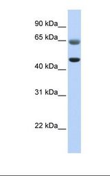 Fetal muscle lysate. Antibody concentration: 1.0 ug/ml. Gel concentration: 12%.
