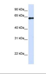 293T cell lysate. Antibody concentration: 1.0 ug/ml. Gel concentration: 12%.