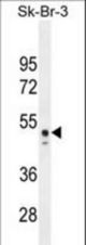 CNO6L Antibody western blot of Sk-Br-3 cell line tissue lysates (35 ug/lane). The CNO6L antibody detected the CNO6L protein (arrow).