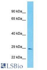 FAM118B antibody Western Blot of Fetal Lung. Antibody dilution: 1 ug/ml.