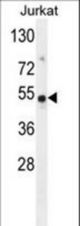 FAM118B Antibody western blot of Jurkat cell line lysates (35 ug/lane). The FAM118B antibody detected the FAM118B protein (arrow).