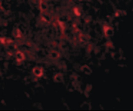 Immunofluorescence of FAM120A in Rat Brain cells with FAM120A antibody at 20 ug/ml.