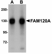 Western blot of FAM120A in SK-N-SH cell lysate with FAM120A antibody at (A) 0.5 and (B) 1 ug/ml. Below: Immunohistochemistry of FAM120A in rat brain tissue with FAM120A antibody at 2.5 ug/ml.