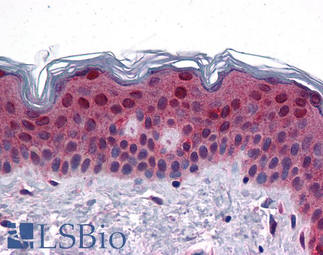 Anti-FAM120B antibody IHC of human skin. Immunohistochemistry of formalin-fixed, paraffin-embedded tissue after heat-induced antigen retrieval. Antibody LS-B4612 concentration 10 ug/ml.