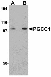 Western blot of PGCC1 in rat thymus tissue lysate with PGCC1 antibody at (A) 0.5 and (B) 1 ug/ml.