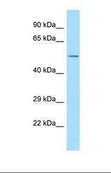 Western blot of Human HepG2. CNOT6L antibody dilution 1.0 ug/ml.