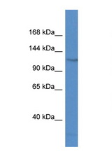 FAM120C antibody LS-C135875 Western blot of Jurkat Cell lysate. Antibody concentration 1 ug/ml.
