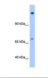 Transfected 293T cell lysate. Antibody concentration: 1.25 ug/ml. Gel concentration: 8%.