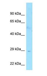 FAM133B antibody Western Blot of Human Small Intestine.