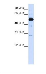Transfected 293T cell lysate. Antibody concentration: 1.0 ug/ml. Gel concentration: 12%.