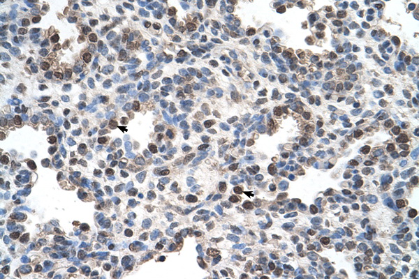 FAM134B antibody LS-C40502 IHC of formalin-fixed, paraffin-embedded human Lung. Positive label: Alveolar cells indicated with arrows. Antibody concentration 4-8 ug/ml. Magnification 400X.