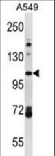 FA13B Antibody western blot of A549 cell line lysates (35 ug/lane). The FA13B antibody detected the FA13B protein (arrow).