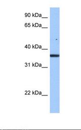 Hela cell lysate. Antibody concentration: 0.5 ug/ml. Gel concentration: 12%.