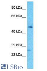 FAM155A antibody Western Blot of PANC1. Antibody dilution: 1 ug/ml.