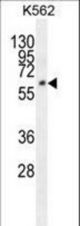 FAM155A Antibody western blot of K562 cell line lysates (35 ug/lane). The FAM155A antibody detected the FAM155A protein (arrow).