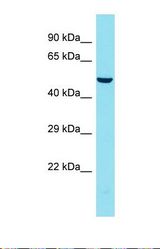 Western blot of Human 293T. FAM155B antibody dilution 1.0 ug/ml.