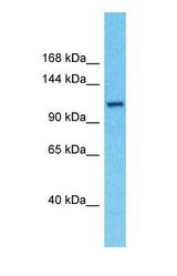 Western blot of FAM160A2 Antibody with human THP-1 Whole Cell lysate.