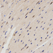 Immunohistochemistry of paraffin-embedded mouse heart tissue using FAM160B2 antibody at dilution of 1:200 (x400 lens)