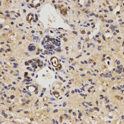 Immunohistochemistry of paraffin-embedded mouse liver fibrosis tissue using FAM160B2 antibody at dilution of 1:200 (x400 lens).